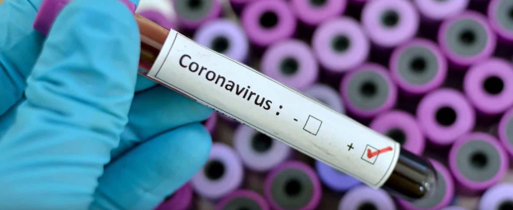 CORONAVIRUS