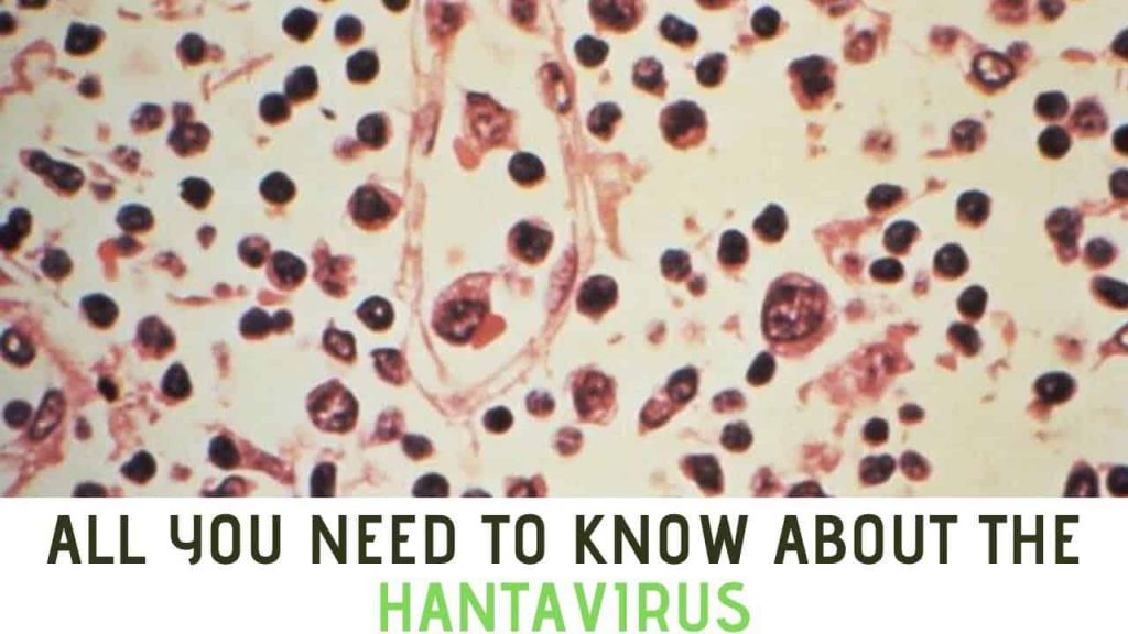 SCIENTISTS CONFIRM HANTAVIRUS IS MORE DEADLY